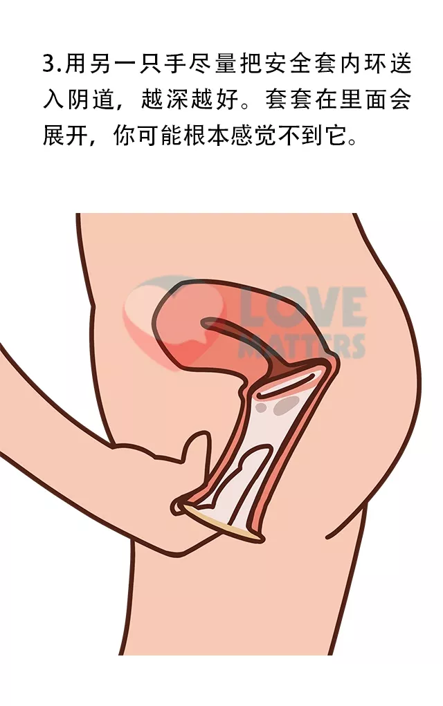 避孕套使用方法图男真人表示图_避孕套使用方法图男真人表示图_避孕套使用方法图男真人表示图