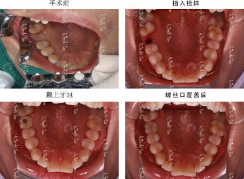 上学没车怎么办_网上学车没看完可以吗_在车上没网络怎么办