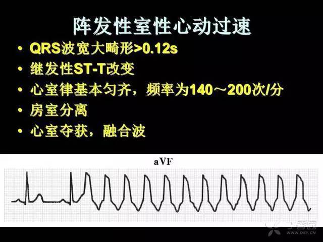 阵发性心房扑动的治疗_阵发性室上性心动过扑_阵发性心房扑动吃什么药